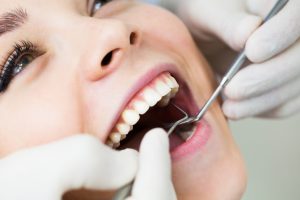 dental checkup