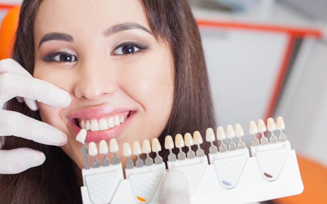 7 Signs You Need a Crown For Your Tooth